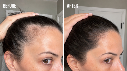 Peptide Hair Growth Serum